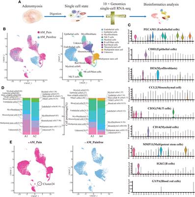 SFRP4+IGFBP5hi NKT cells induced neural-like cell differentiation to contribute to adenomyosis pain